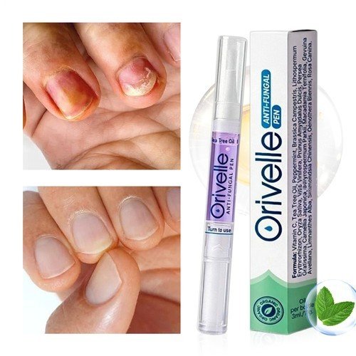 How Orivelle works